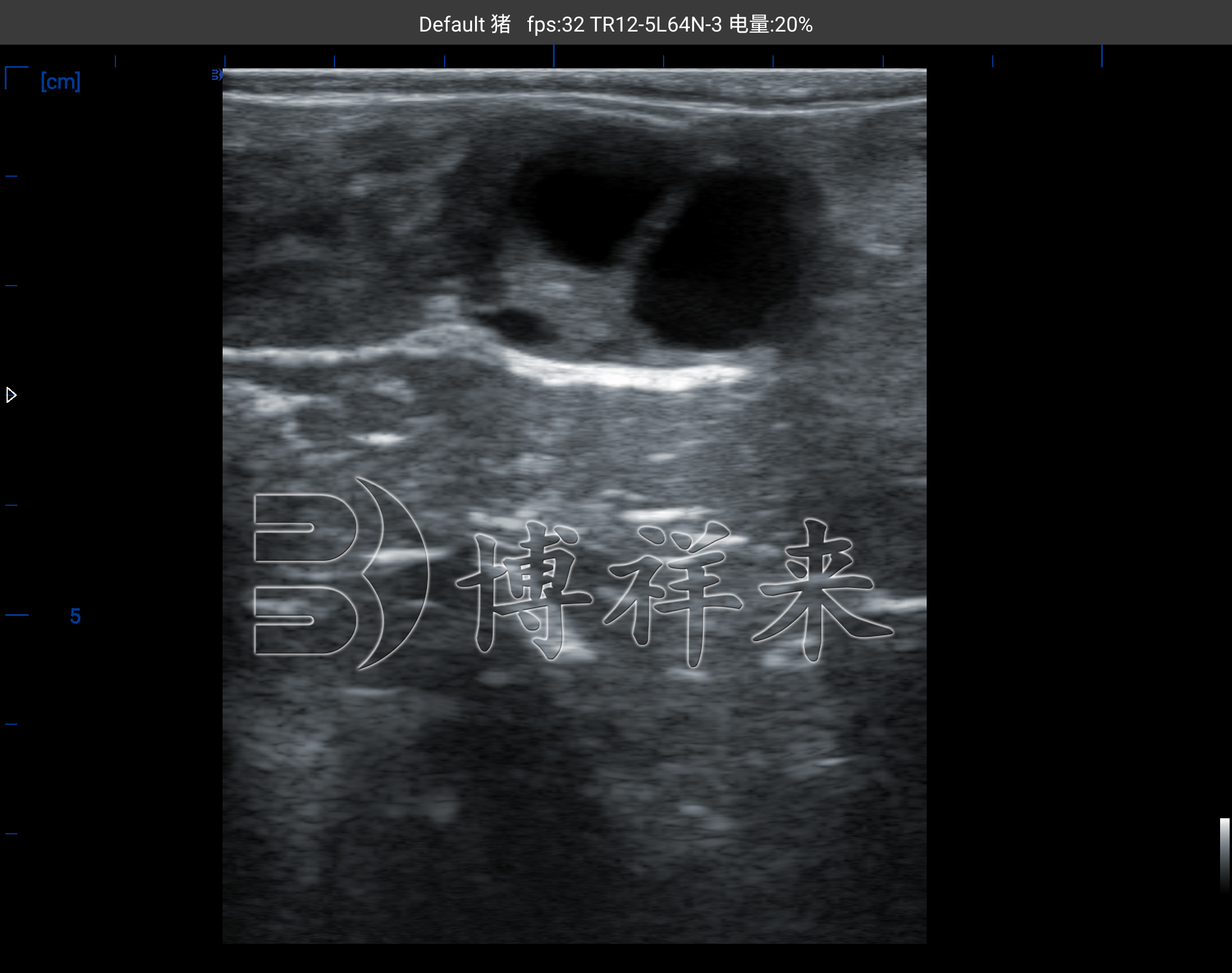 牛用B超机测母牛卵泡图